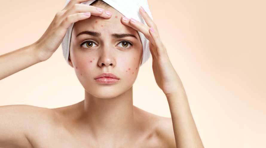 How To Get Rid Of Dark Spots On Your Skin